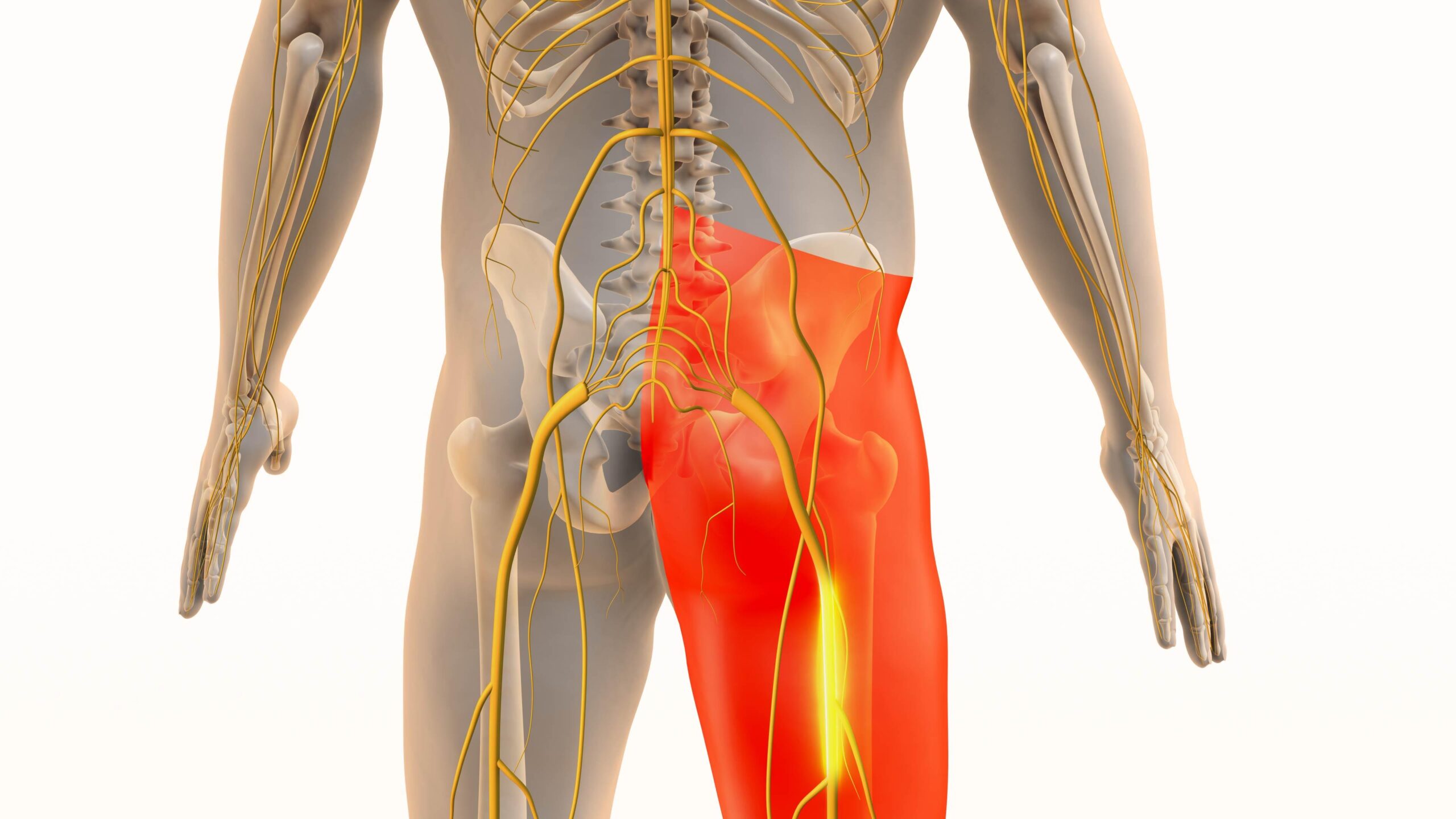 sciatica nerve physiotherapy in malad